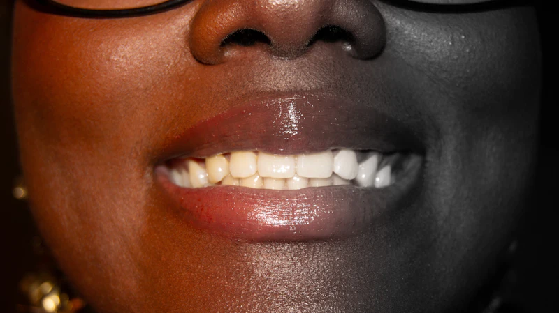 Close-up of a smile showing white front teeth
