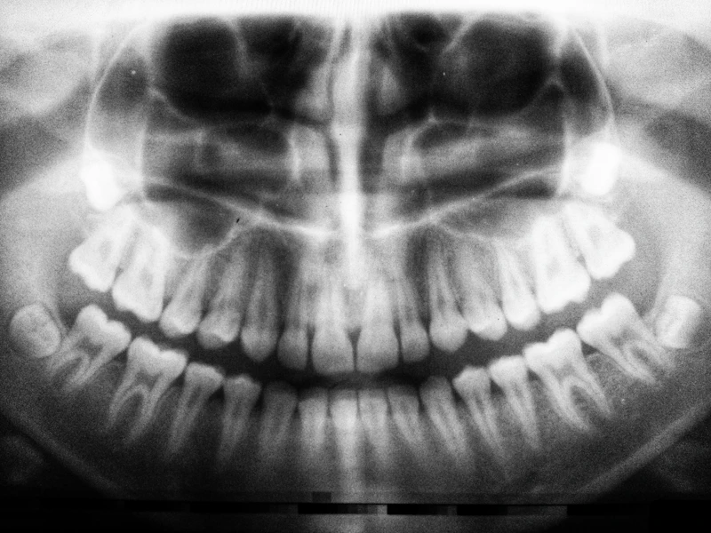 A panoramic X-ray showing a full set of teeth and the jaw