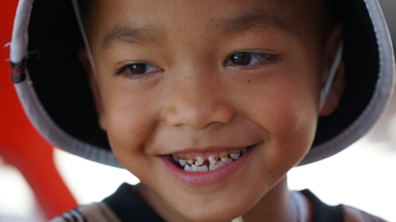 A smiling young boy showing a gap where a milk tooth has fallen out