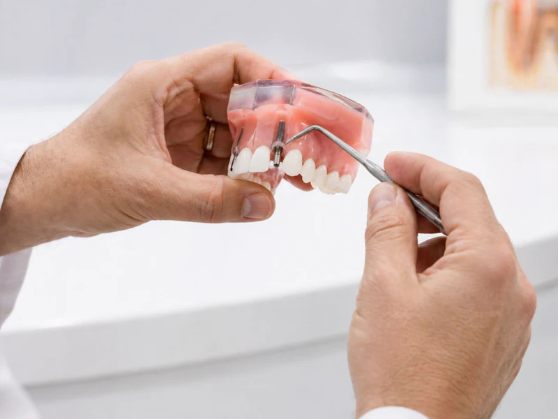 Hands pointing a dental probe at an implant screw on a denture model